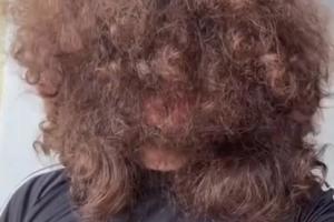 凌乱无比！曼联英超首轮失利，球迷“蓄发哥”已688天未理发